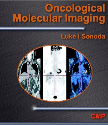 Oncological Molecular Imaging