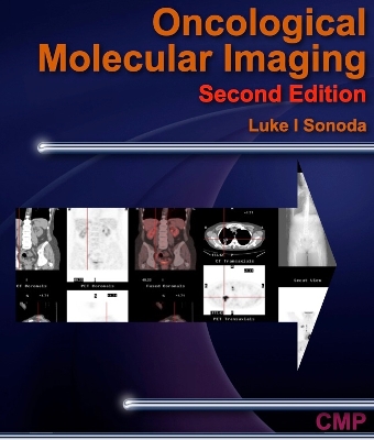 Oncological Molecular Imaging Second Edition