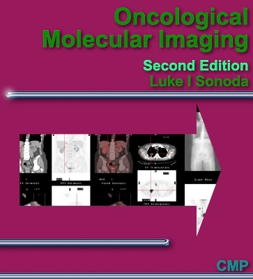 Oncological Molecular Imaging Second Edition