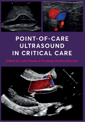 Point-of-Care Ultrasound in Critical Care