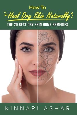 How to Heal Dry Skin Naturally