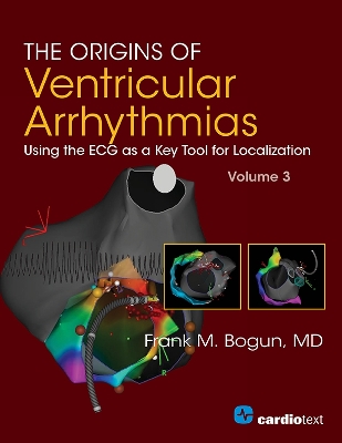 Origins of Ventricular Arrhythmias, Volume 3