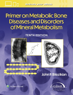 Primer on the Metabolic Bone Diseases and Disorders of Mineral Metabolism