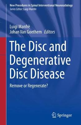 Disc and Degenerative Disc Disease