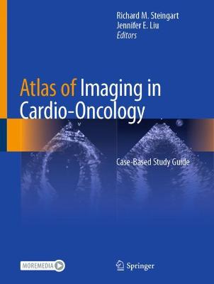 Atlas of Imaging in Cardio-Oncology