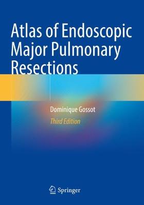 Atlas of Endoscopic Major Pulmonary Resections