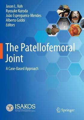 The Patellofemoral Joint