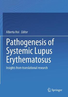 Pathogenesis of Systemic Lupus Erythematosus