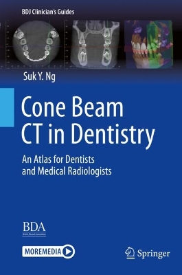 Cone Beam CT in Dentistry