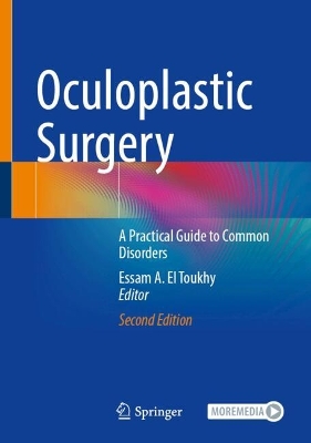 Oculoplastic Surgery