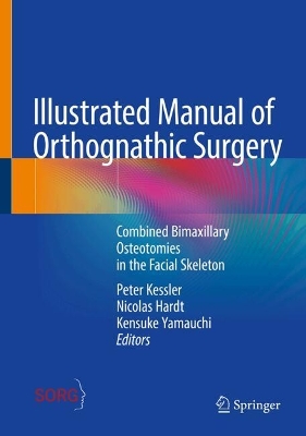 Illustrated Manual of Orthognathic Surgery