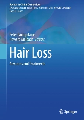 Hair Loss