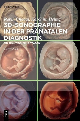 3d-Sonographie in Der Pr?natalen Diagnostik