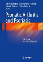 Psoriatic Arthritis and Psoriasis