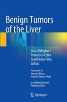 Benign Tumors of the Liver