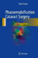 Phacoemulsification Cataract Surgery