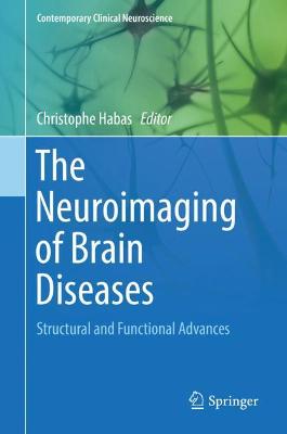 Neuroimaging of Brain Diseases