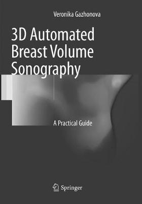 3D Automated Breast Volume Sonography