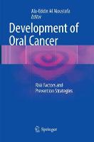 Development of Oral Cancer