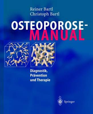 Osteoporose-Manual