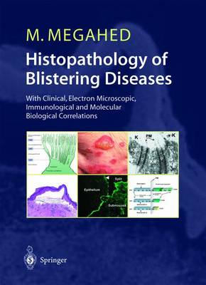 Histopathology of Blistering Diseases