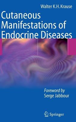 Cutaneous Manifestations of Endocrine Diseases