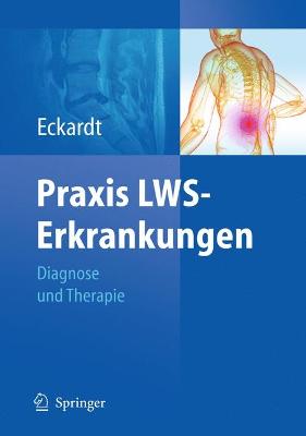 Praxis LWS-Erkrankungen