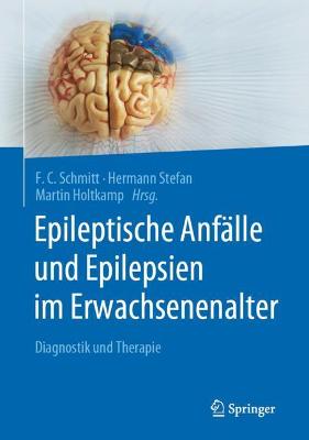 Epileptische Anfaelle und Epilepsien im Erwachsenenalter