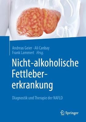 Nicht-alkoholische Fettlebererkrankung