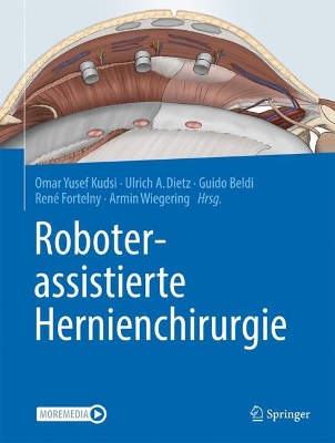 Roboterassistierte Hernienchirurgie