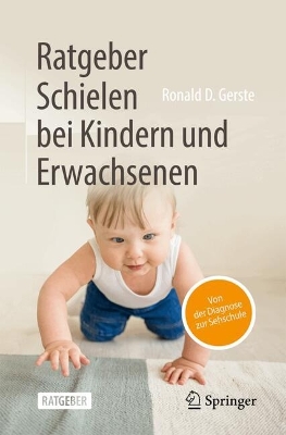 Ratgeber Schielen bei Kindern und Erwachsenen