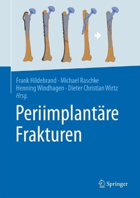 Periimplantaere Frakturen