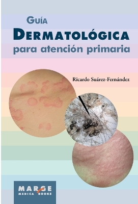 Guia dermatologica para atencion primaria