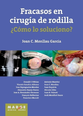 Fracasos en cirugia de rodilla ?Como lo soluciono?