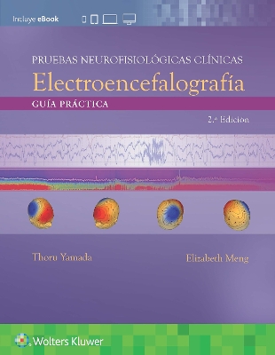 Pruebas neurofisiologicas clinicas. Electroencefalografia