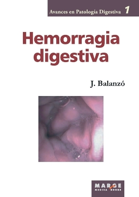 Hemorragia digestiva