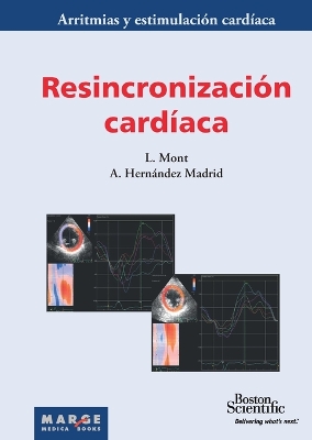 Resincronizacion cardiaca