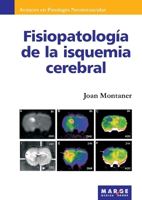 Fisiopatologia de la isquemia cerebral