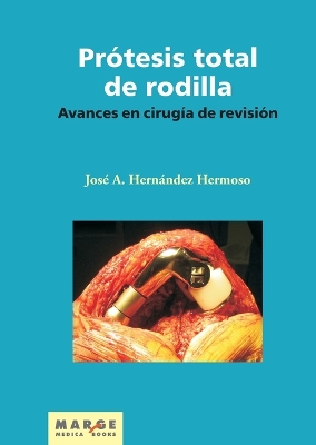 Avances en cirugia de revision de la protesis total de rodilla