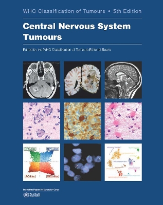WHO classification of tumours of the central nervous system