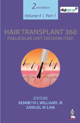 Hair Transplant 360: Follicular Unit Excision (FUE)