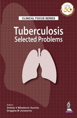 Clinical Focus Series: Tuberculosis