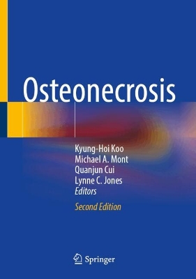 Osteonecrosis