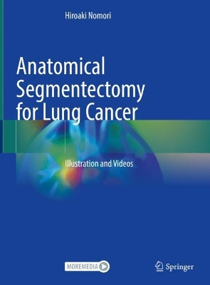 Anatomical Segmentectomy for Lung Cancer