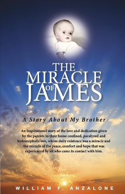 The Miracle of James