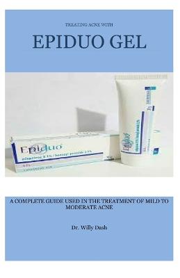 Treating Acne with Epiduo Gel