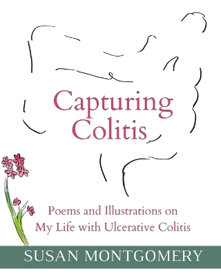 Capturing Colitis