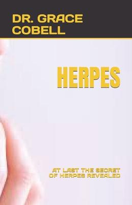 Herpes