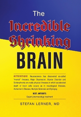 The Incredible Shrinking Brain
