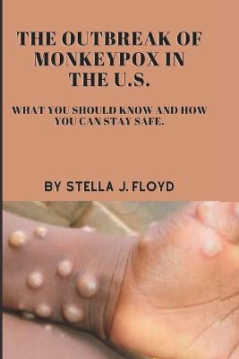 outbreak of monkeypox in the U.S